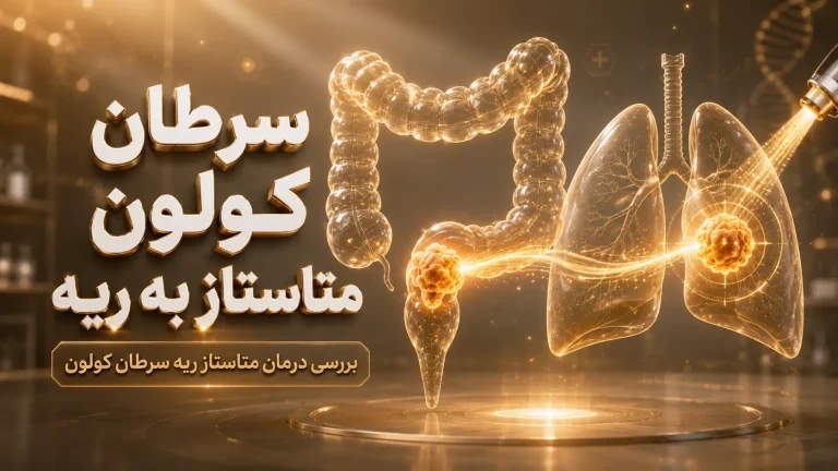 سرطان کولون متاستاز به ریه | بررسی درمان متاستاز ریه سرطان کولون
