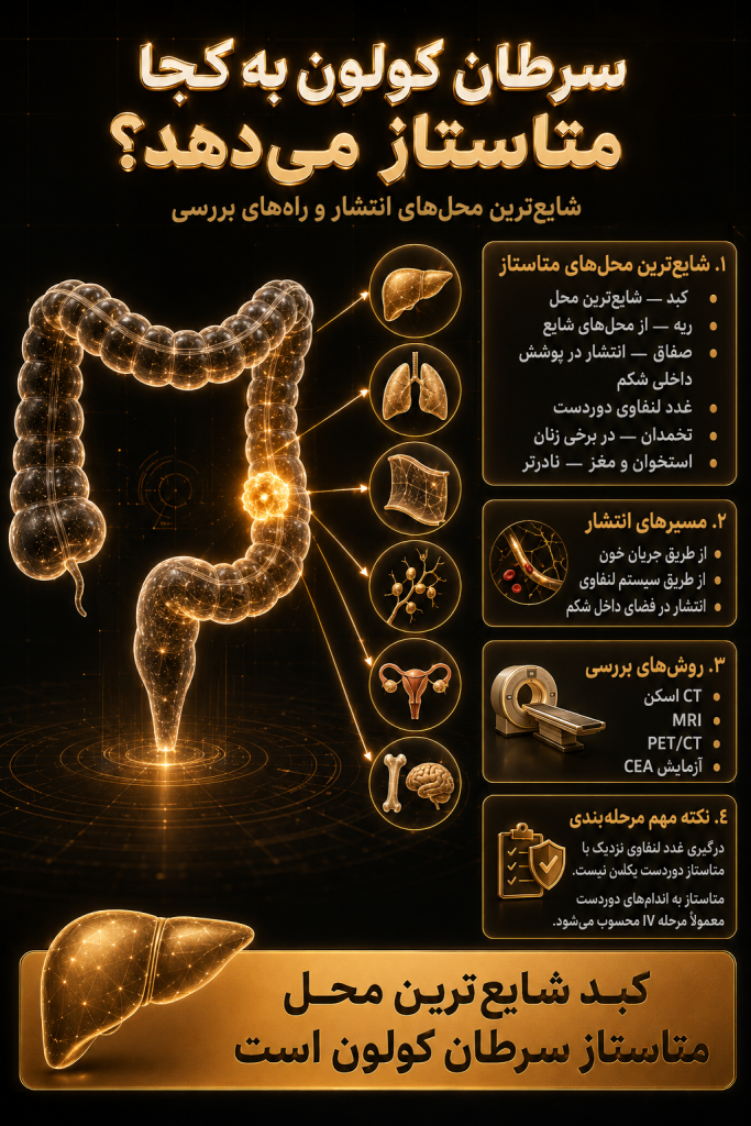 اینفوگرافیک متاستاز سرطان کولون